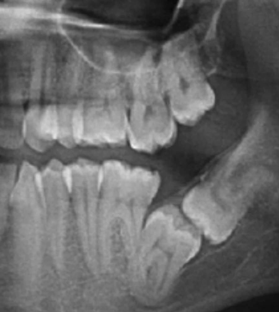 Digital X-Ray (Radiography) — Clinical Dental Care at Dant काया Multispeciality Clinic, Patna