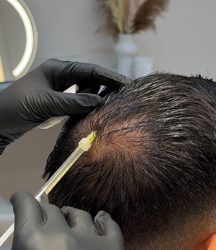 PRP of Face & Hair — Clinical Skin & Facial Aesthetics at Dant काया Multispeciality Clinic, Patna